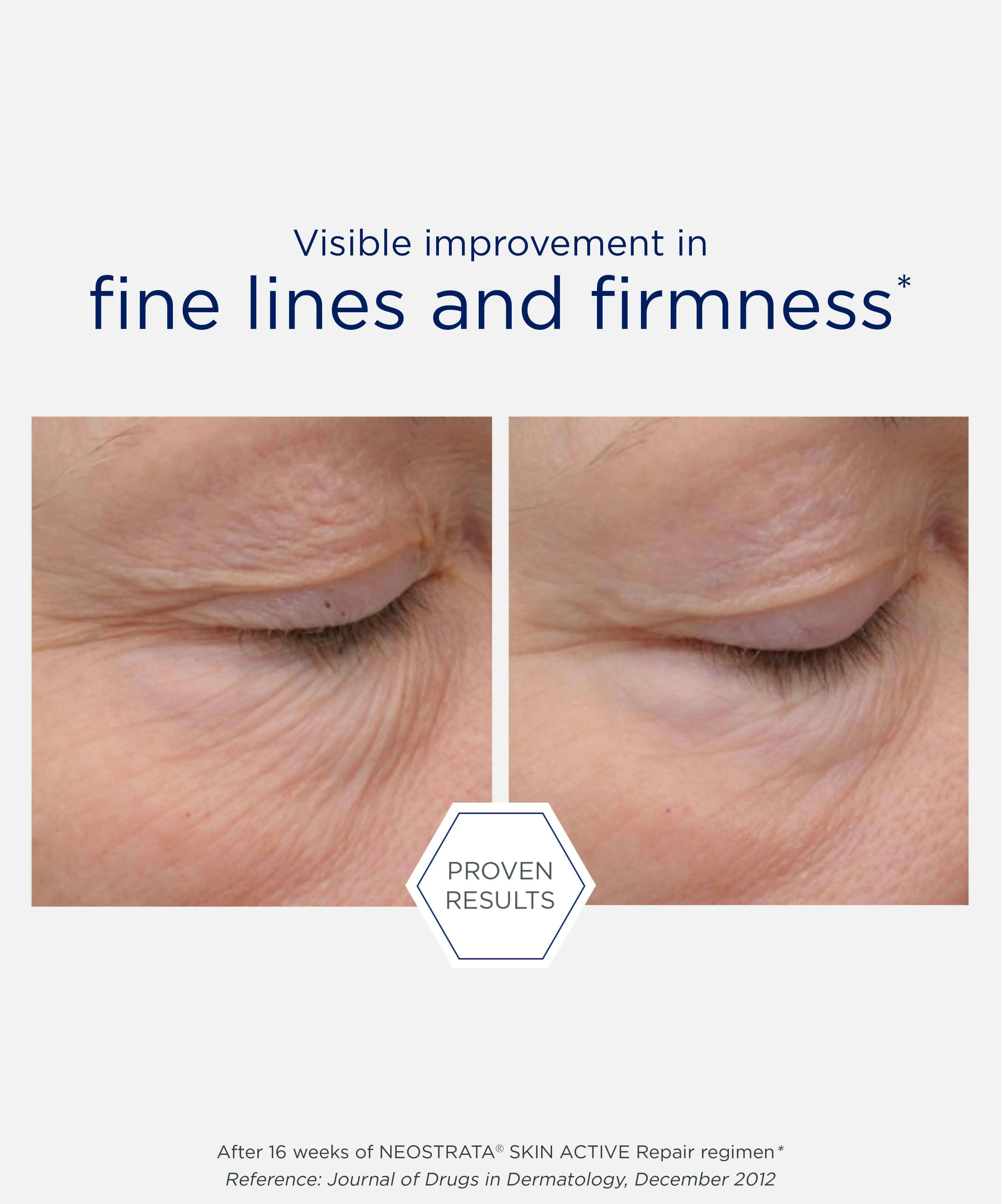 Intensive Eye Therapy - Image 6